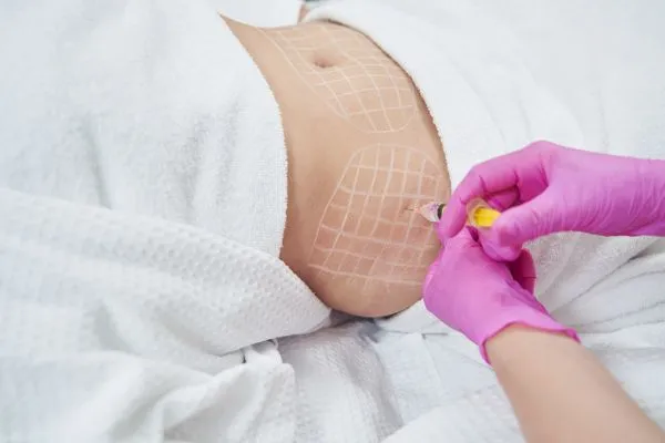 image of fat dissolving injections on love handles to help combat weight gain Craiglockhart