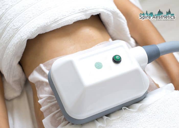 Shift Those Extra Pounds: How Fat Freezing Can Help You Slim Down Craiglockhart